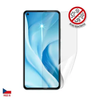 Bildschirmschutz Anti-Bakterien XIAOMI 11 Lite 5G NE Bildschirmfolie Bildschirmschutz Anti-Bakterien XIAOMI 11 Lite 5G NE Bildschirmfolie